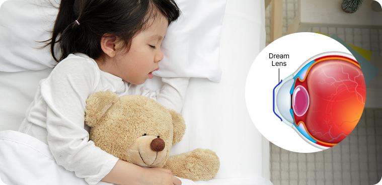 드림렌즈란?