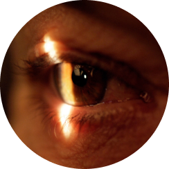Individuals with inflammatory eye conditions or vascular diseases