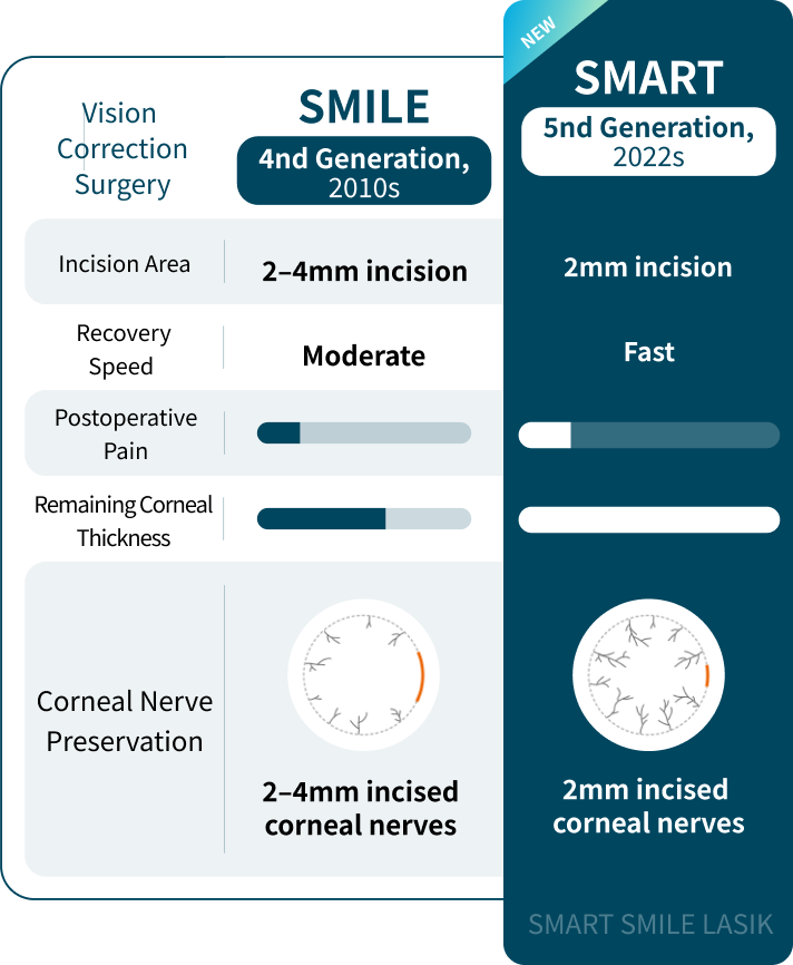 스마일 라식 특징