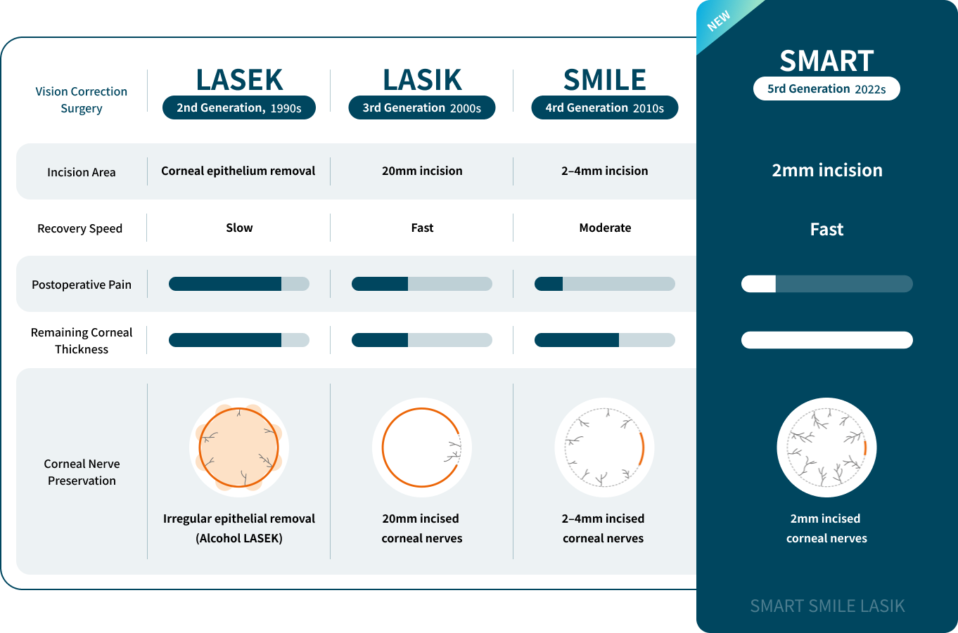 스마일 라식 특징